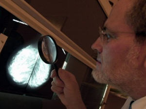 Dépistage du cancer du sein Dépistage du cancer du sein