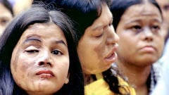 Des femmes victimes d'attaques à l'acide, au Bangladesh, qui manifestent à l'occasion de la Journée internationale de la femme, en 2004. Des femmes victimes d'attaques à l'acide, au Bangladesh, qui manifestent à l'occasion de la Journée internationale de la femme, en 2004.