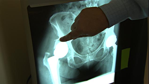 110215_37p00_hanche-radiographie-docteur 110215_37p00_hanche-radiographie-docteur