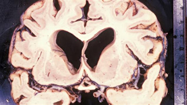 Un cerveau Un cerveau
