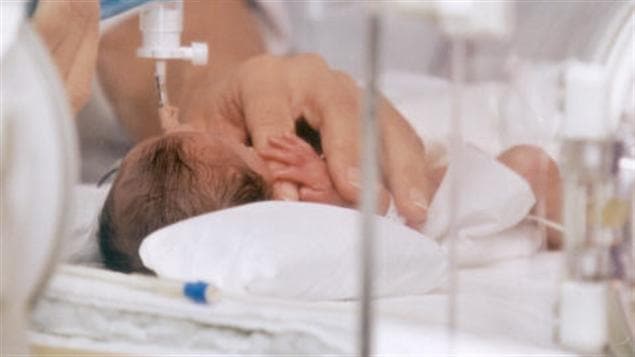Un bébé prématuré Un bébé prématuré