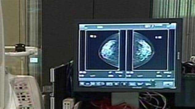Dépistage du cancer du sein Dépistage du cancer du sein