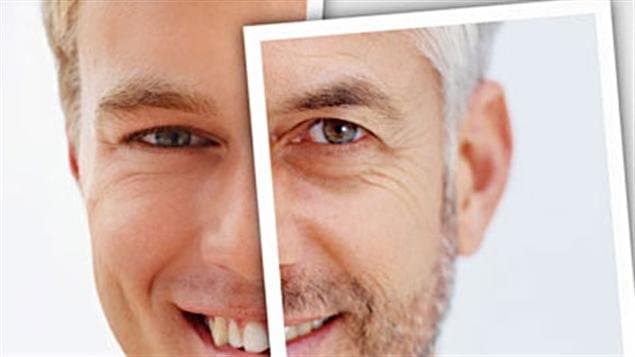 Vieillissement d'un visage Vieillissement d'un visage