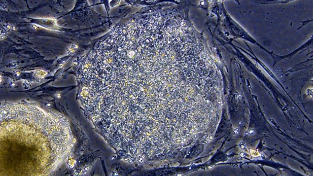 Une cellule souche embryonnaire Une cellule souche embryonnaire