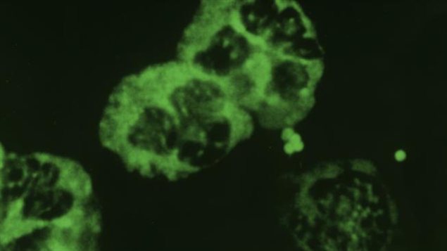 La bactérie Neisseria gonorrhoeae La bactérie Neisseria gonorrhoeae