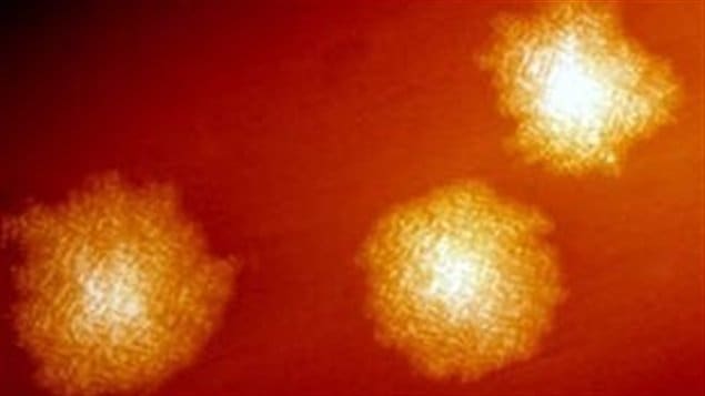 La bactérie C. difficile La bactérie C. difficile