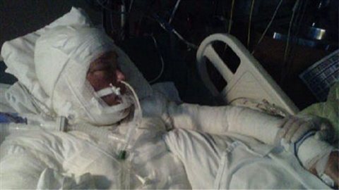 Tanya St Arnauld est maintenue dan sun coma artificiel au Centre des grands brûlés de l'Hôtel-Dieu, à Montréal. Tanya St Arnauld est maintenue dan sun coma artificiel au Centre des grands brûlés de l'Hôtel-Dieu, à Montréal.