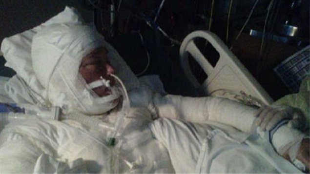 Tanya St Arnauld est maintenue dan sun coma artificiel au Centre des grands brûlés de l'Hôtel-Dieu, à Montréal. Tanya St Arnauld est maintenue dan sun coma artificiel au Centre des grands brûlés de l'Hôtel-Dieu, à Montréal.
