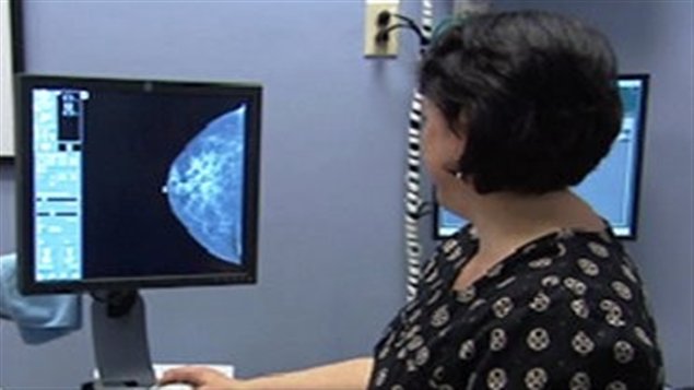 Une mammographie Une mammographie