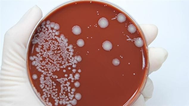 Scientist holding an agar plate which is growing E.coli Scientist holding an agar plate which is growing E.coli