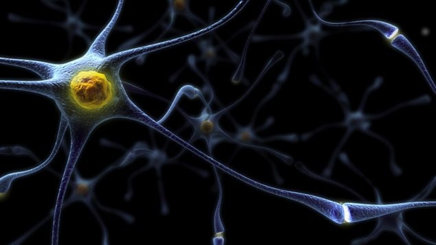 Représentation d'un neurone. Dans l'alzheimer, les plaques séniles compriment les neurones. Représentation d'un neurone. Dans l'alzheimer, les plaques séniles compriment les neurones.