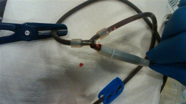 Une goutte de sang perle sur le connecteur défectueux d'un dispositif de prélèvement du sang. Une goutte de sang perle sur le connecteur défectueux d'un dispositif de prélèvement du sang.