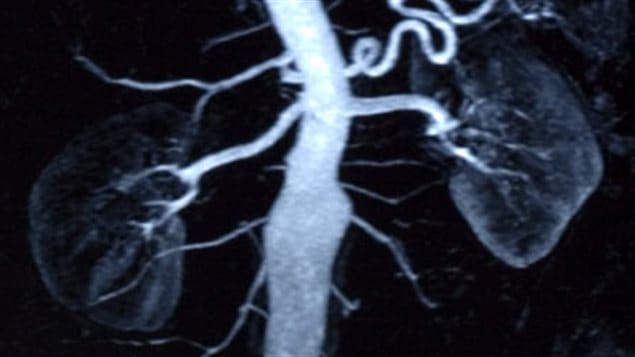Radiographie des reins Radiographie des reins