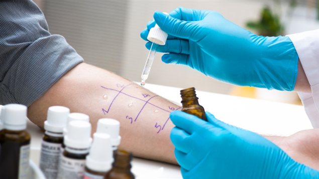 Un test d'allergie Un test d'allergie