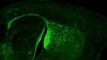 Cerveau de souris affectée par une démyélinisation chronique. L'intensité de la fluorescence verte est grandement diminuée. Cerveau de souris affectée par une démyélinisation chronique. L'intensité de la fluorescence verte est grandement diminuée.