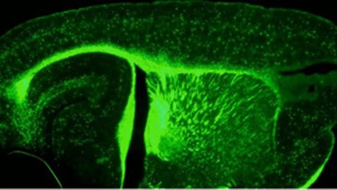 Cerveau de souris traitée par la testostérone pendant 6 semaines après une démyélinisation sévère. Une récupération importante est observée suite à ce traitement. Cerveau de souris traitée par la testostérone pendant 6 semaines après une démyélinisation sévère. Une récupération importante est observée suite à ce traitement.