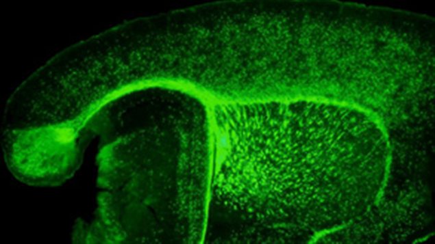Coupe du cerveau de souris. La myéline et les cellules myélinisantes ont été rendues fluorescentes afin de faciliter l'identification et le suivi de la destruction de la myéline et sa réparation. Coupe du cerveau de souris. La myéline et les cellules myélinisantes ont été rendues fluorescentes afin de faciliter l'identification et le suivi de la destruction de la myéline et sa réparation.
