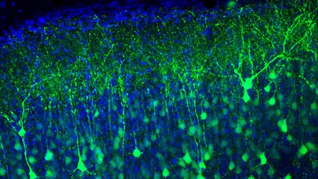 Cette image montre in utero le soma et des dendrites des neurones de la couche supérieure du cortex. En bleu, les noyaux. Cette image montre in utero le soma et des dendrites des neurones de la couche supérieure du cortex. En bleu, les noyaux.