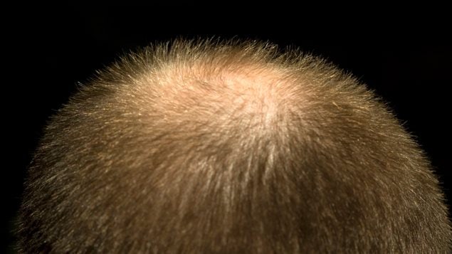 Une tonsure Une tonsure