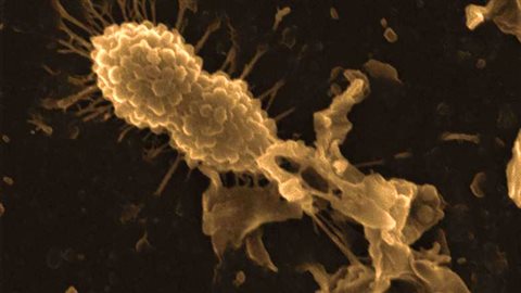 Une bactérie saine de streptocoque de la pneumonie (en haut à gauche) et une bactérie détruite par la protéine alpha lactalbumine modifiée tueuse de cellules tumorales (HAMLET) (à droite) Une bactérie saine de streptocoque de la pneumonie (en haut à gauche) et une bactérie détruite par la protéine alpha lactalbumine modifiée tueuse de cellules tumorales (HAMLET) (à droite)