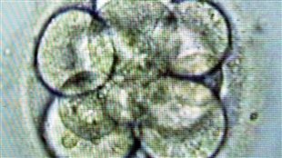 Division cellulaire d'un embryon humain vue au microscope Division cellulaire d'un embryon humain vue au microscope
