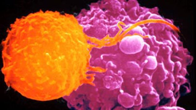 Une cellule lymphocyte T (en orange) attaque une tumeur cancéreuse (en rose) Une cellule lymphocyte T (en orange) attaque une tumeur cancéreuse (en rose)