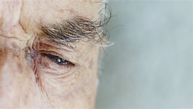 Homme atteint d'alzheimer Homme atteint d'alzheimer