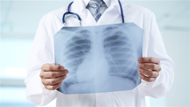 Un médecin regarde la radiographie d'une cage thoracique. Un médecin regarde la radiographie d'une cage thoracique.