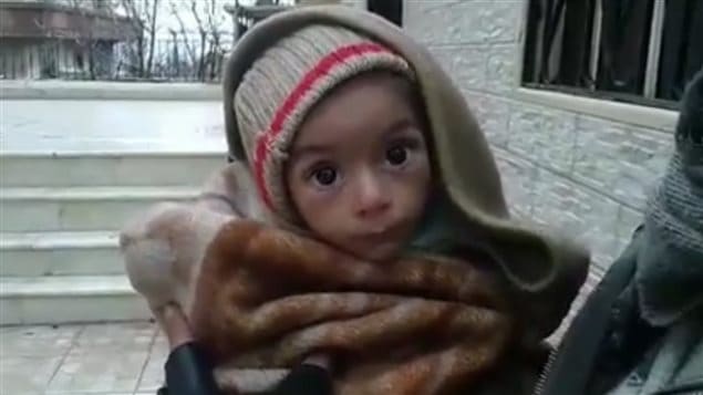 Des images ont fait surface dans les derniers jours sur les réseaux sociaux montrant des enfants syriens amaigris jusqu’aux os. Des images ont fait surface dans les derniers jours sur les réseaux sociaux montrant des enfants syriens amaigris jusqu’aux os.