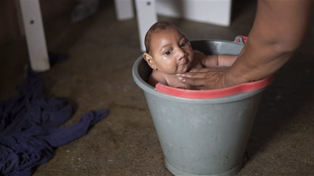 La brésilienne Solange Ferreira est devenue l'une des centaines de femmes infectées par le virus Zika. Elle a donné naissance à Jose, atteint de microcéphalie. La brésilienne Solange Ferreira est devenue l'une des centaines de femmes infectées par le virus Zika. Elle a donné naissance à Jose, atteint de microcéphalie.