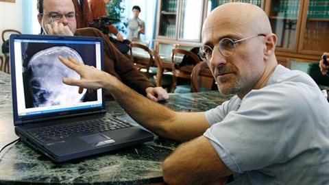 Sergio Canavero Sergio Canavero