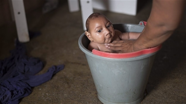 Bébé brésilien atteint de microcéphalie, né d'une mère infectée par le virus Zika Bébé brésilien atteint de microcéphalie, né d'une mère infectée par le virus Zika