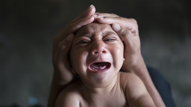 In this Jan. 30, 2016 photo, Elielson tries to calm down his baby brother Jose Wesley, in Bonito, Pernambuco state, Brazil. Jose Wesley was born with microcephaly and he screams uncontrollably for long stretches, getting red in the face and tightening his already stiff limbs. In this Jan. 30, 2016 photo, Elielson tries to calm down his baby brother Jose Wesley, in Bonito, Pernambuco state, Brazil. Jose Wesley was born with microcephaly and he screams uncontrollably for long stretches, getting red in the face and tightening his already stiff limbs.