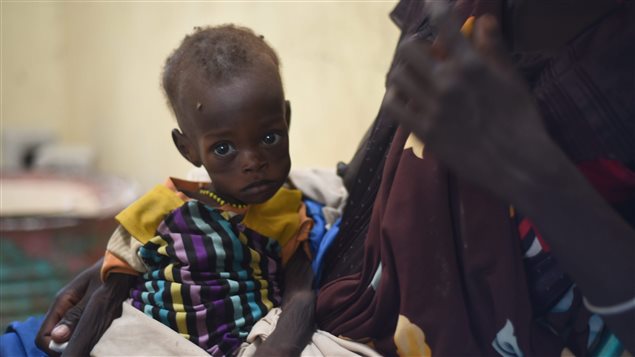 Nyagoah Taka Gatluak, un enfant souffrant de malnutrition attend la visite du docteur en compagnie de sa mère dans une clinique de Médecins sans frontières de la ville de Leer, au Soudan du Sud. Nyagoah Taka Gatluak, un enfant souffrant de malnutrition attend la visite du docteur en compagnie de sa mère dans une clinique de Médecins sans frontières de la ville de Leer, au Soudan du Sud.