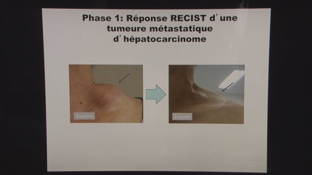 Virothérapie Virothérapie
