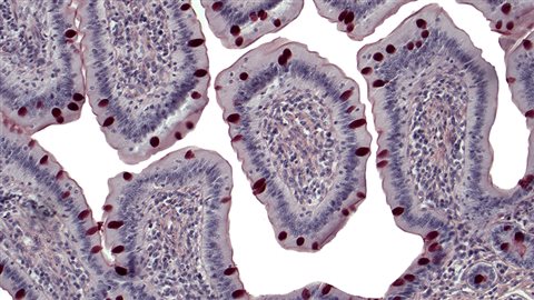 Villosités intestinales Villosités intestinales