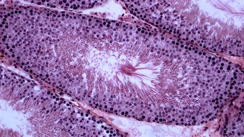 Coupe de la formation des spermatozoïdes Coupe de la formation des spermatozoïdes