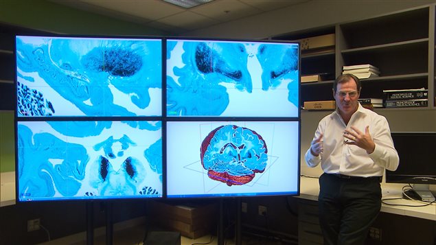 Le laboratoire du professeur Alan Evans, chef de groupe adjoint à l’Institut et hôpital neurologiques de Montréal de l’Université McGill, est reconnu mondialement pour son atlas du cerveau. Le laboratoire du professeur Alan Evans, chef de groupe adjoint à l’Institut et hôpital neurologiques de Montréal de l’Université McGill, est reconnu mondialement pour son atlas du cerveau.