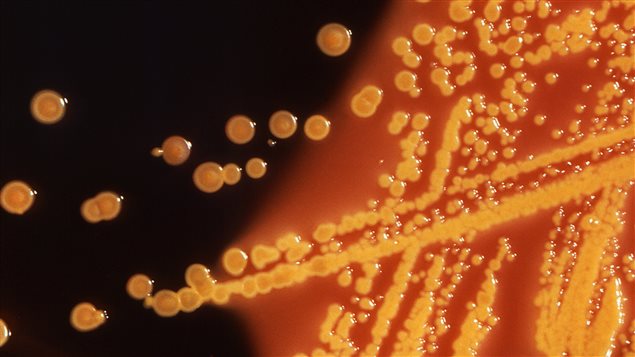 Des colonies de bactéries E. coli dans une image microscopique partagée par le Centre américain de contrôle des maladies (CDC). Des colonies de bactéries E. coli dans une image microscopique partagée par le Centre américain de contrôle des maladies (CDC).