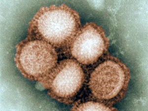 Une photo du virus de la grippe A (H1N1) Une photo du virus de la grippe A (H1N1)