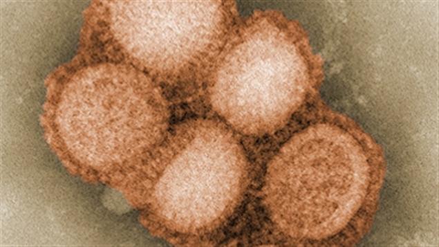 Le virus du H1N1 photographié dans les laboratoires du Center for Disease Control Le virus du H1N1 photographié dans les laboratoires du Center for Disease Control