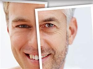 Vieillissement d'un visage Vieillissement d'un visage