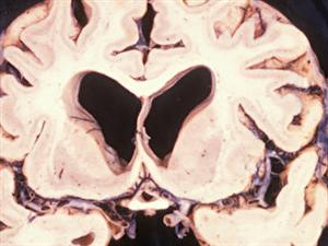 Un cerveau Un cerveau