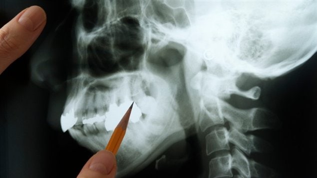 Radiographie d'une mâchoire humaine Radiographie d'une mâchoire humaine