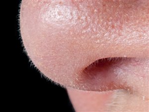 Un nez Un nez
