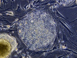 Une cellule souche embryonnaire Une cellule souche embryonnaire