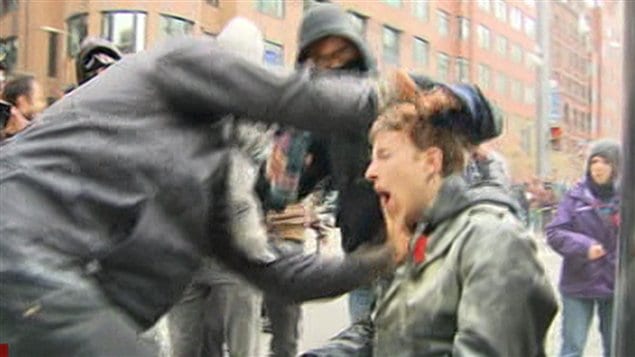 Un étudiant blessé à un oeil par un projectile tiré par les policiers. Un étudiant blessé à un oeil par un projectile tiré par les policiers.