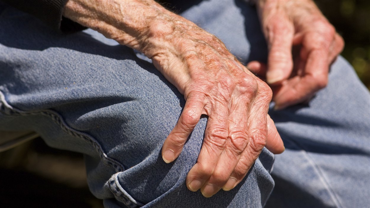 Le tremblement essentiel affecte surtout les mains des personnes affligées Le tremblement essentiel affecte surtout les mains des personnes affligées