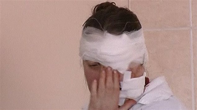 Une femme blessée au visage est traitée dans un hôpital de la région. Une femme blessée au visage est traitée dans un hôpital de la région.