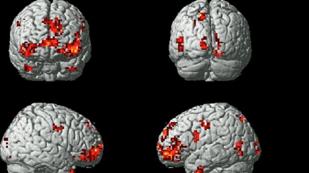 Le cerveau durant l'examen Le cerveau durant l'examen